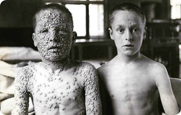 18일 오후 독감 예방접종을 위해 보호자와 함께 경북 경산의 한 소아과병원을 방문한 어린이가 진료를 마치고 주사를 맞고 있다.  대구보건환경연구원은 최근 대구지역 병원을 찾은 호흡기 환자 가운데 6명에게서 올해 첫 인플루엔자(독감) 바이러스가 검출됐다고 18일 밝혔다. 2017.12.18/뉴스1